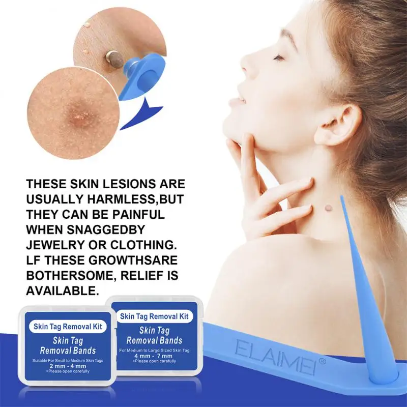 

2 In 1 Auto Skin Tag Removal Kit Micro Skin Tag Treatment Tool Painless Mole Wart Remover Equipment Easy To Clean Skin Care Tool
