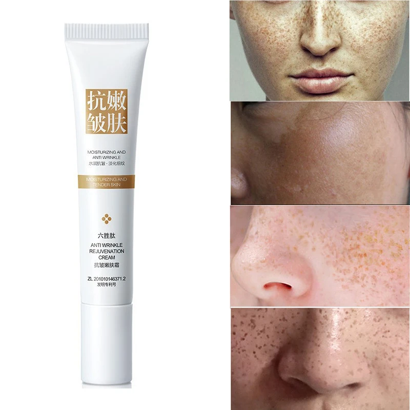 20g Whitening Freckle Cream Remove Melasma Acne Spot Pigment Melanin Dark Spots Whitening Moisturizing Cream Skin Care