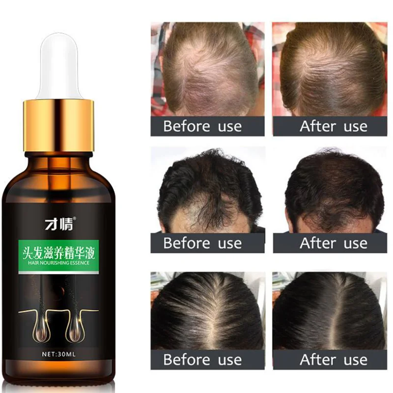 

10ml Hair Growth Essential Oils Nourishing Soften Treatment Hair Loss Repair Hair Loss Liquid Beauty Dense Hair Products