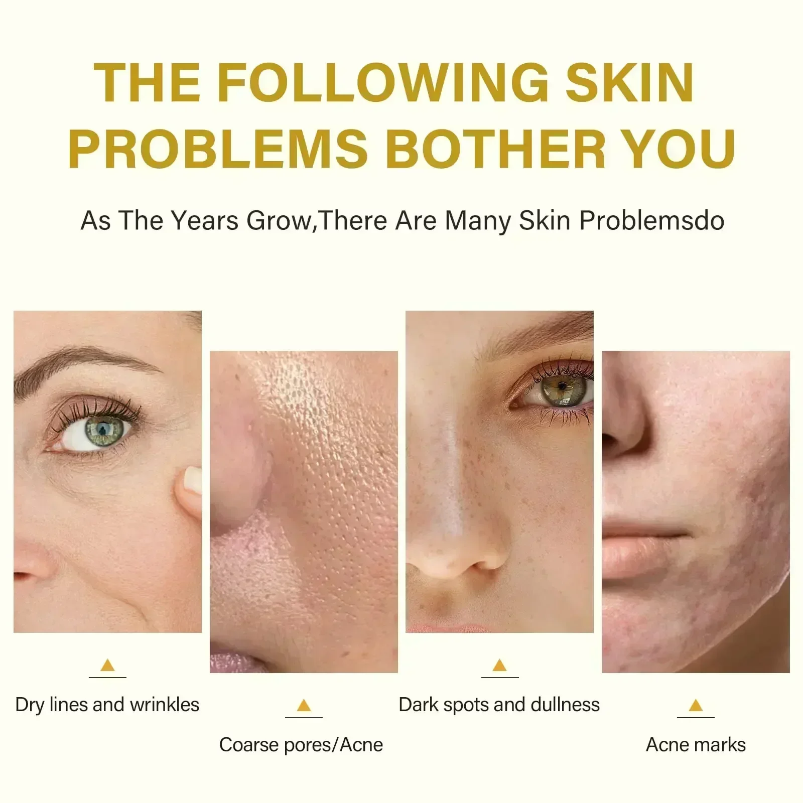 ciemne plamy skóry usuń martwy naskórek rozjaśniający peeling z melaniny złuszczający nawilżający pielęgnacja twarzy New3