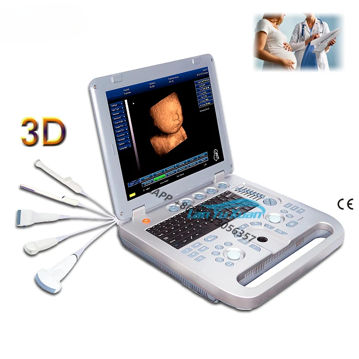 

Ultrasound 15 Inches High Performance Laptop 3D Heart Ultrasound Medical Diagnostic Instrument Sun-800D