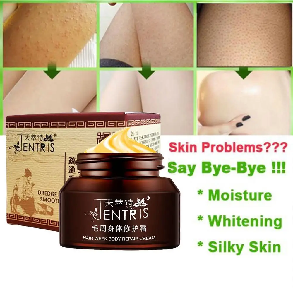 Curing Keratosis Pilaris Kp Chicken Skin Repair Cream Body Lotion Moisturizing and Nourishing Skin Care Essence 50g Body Care