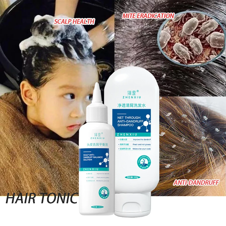 Hair Care Set Anti-Dandruff Shampoo Lice Mites Remover Shampoo Scalp Follicle Dissolve Oil Antipruritic Anti Hair Loss Treatment
