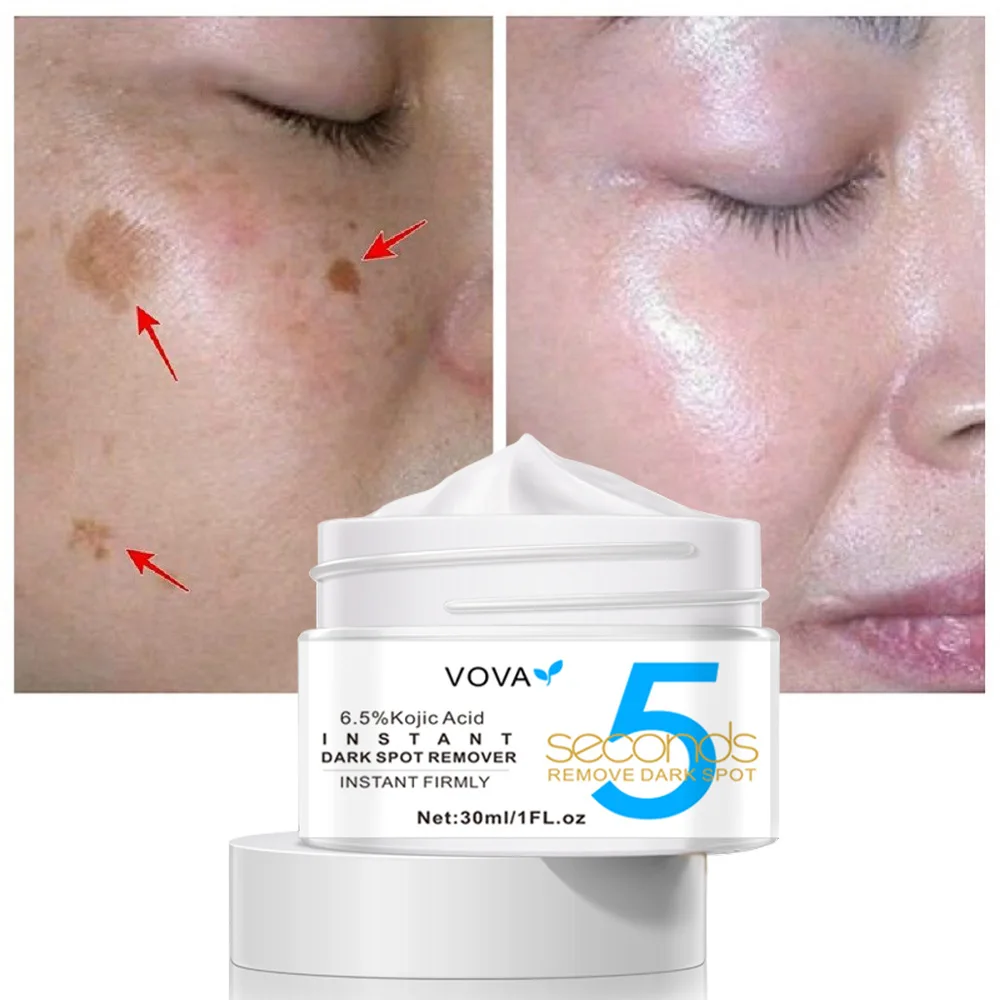 

Skin Care Dark Spot Cream Anti-Wrinkle Anti-Aging Whitening Anti-Freckle Facial nurse Beauty Health Skincare