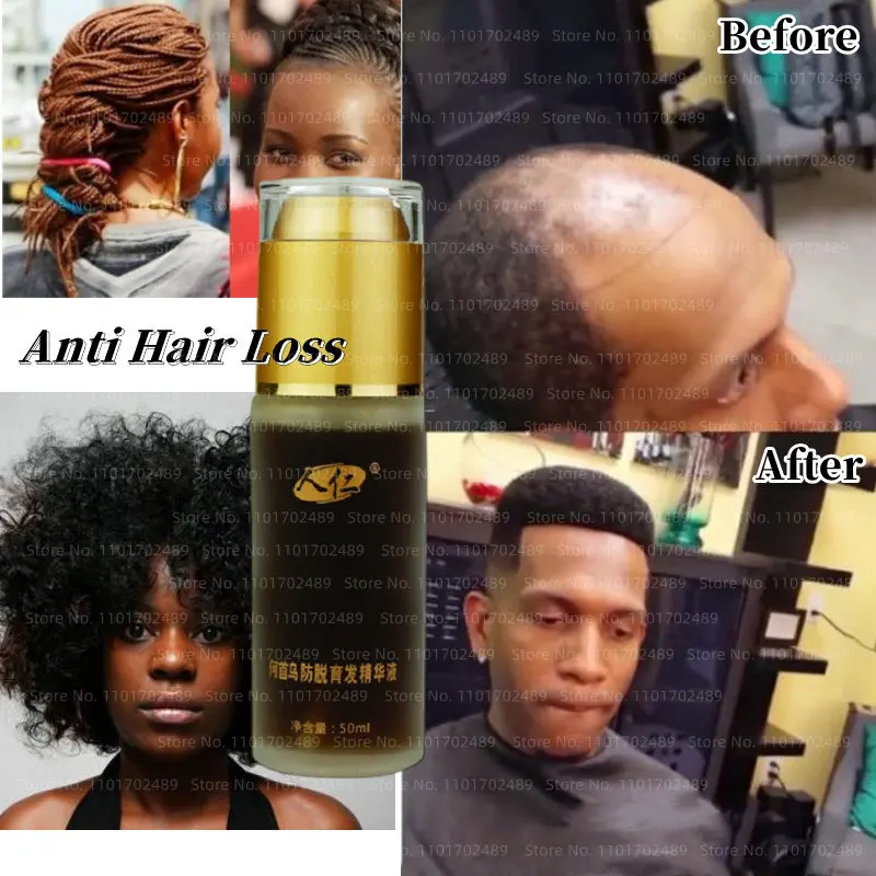 

50ml Natural Curly Hair Growth Product Anti Hair Loss Shampoo Efficient Straighten Hair Herbal Essential Oils for Men