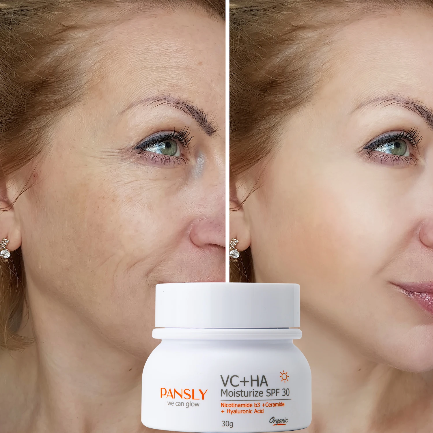 

Vitamin C Face Whitening Cream Hyaluronic Acid Dark Spot Corrector Brightening Moisturizing Sunscreen SPF 30 SkinCare Product