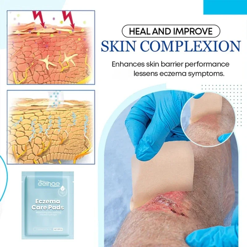 Пластырь для лечения экземы лечение псориаза тинея ингибитор дерматита грибка