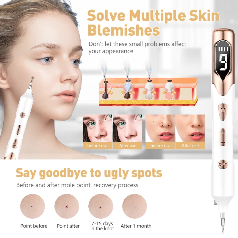 

Plasma Laser Pen Removal Freckles Blemish Removal Papillary Warts Acne Tattoo Laser Spot Removal Pen Electric Beauty Care Tool