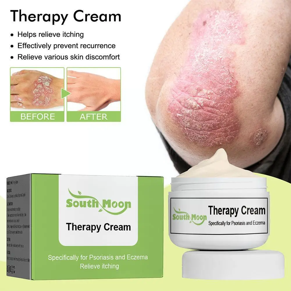 

20g Psoriasis Treatment Cream Herbal Antibacterial Eczema Therapy Relief Cream Urticaria Scaling Rash Itching C0N1