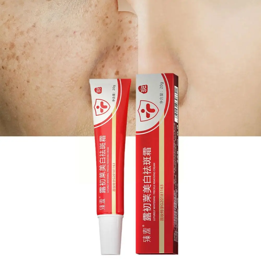 Рисунок 5 - Отбеливание веснушек крем в черные точки