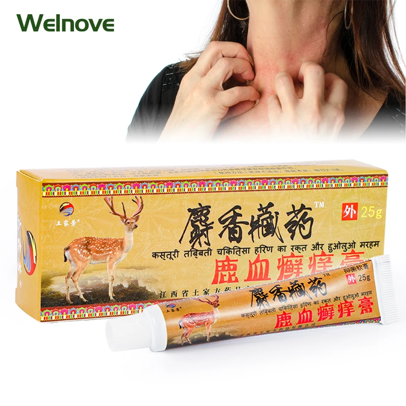 

25G Psoriasis Antibacterial Cream Eczema Dermatitis Pruritus Eczematoid Chinese Herbal Medical Anti-Itching Ointment Skin Care