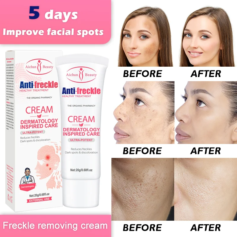 

20ML Cream Freckle Face Care Moisturizer Brighten Faded Dark Niacinamide Spot Corrector Removal Pigment Melanin Correcting Skin