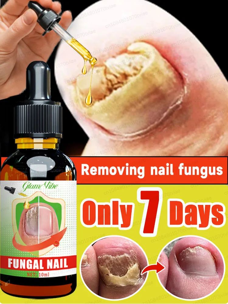 FNaziTOéal MOB FRaziЭфирные решения NТовары NFRGGAazi ИКулКонгеары CFNZor Mayor RPPazi