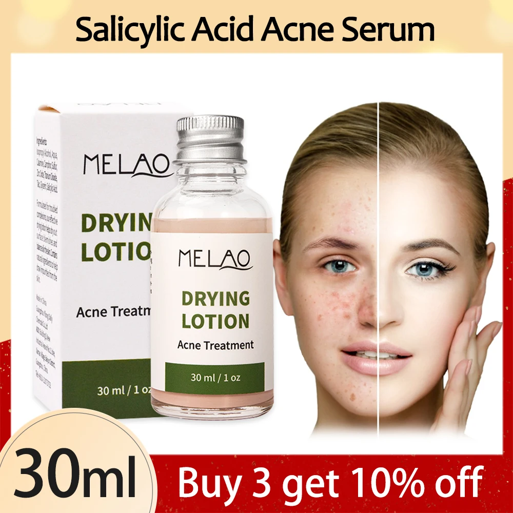 

Salicylic Acid Acne Serum Oil Control Mild Repair Treatment Skin Black Dots Remove Shrink Pores Whiten Moisturize Essence Care