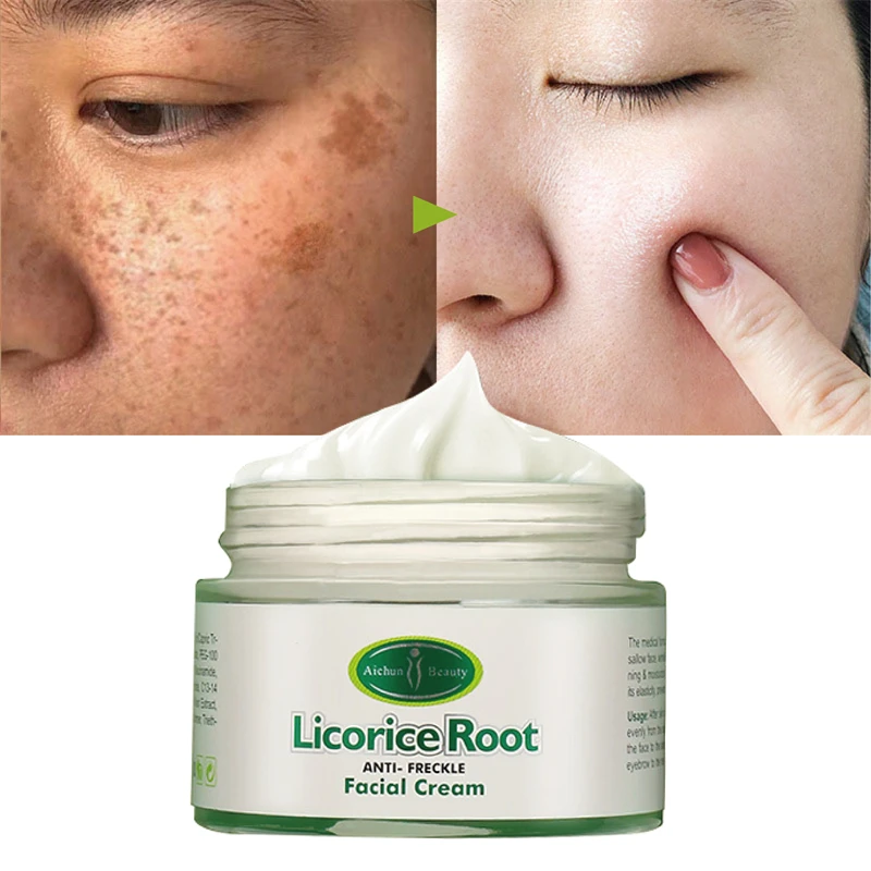 

Whitening Cream Freckle Cream Remove Dark Spots Fade Acne Scars Melanin Pigmentation Melasma Anti-Aging Brighten Skin Care 50g