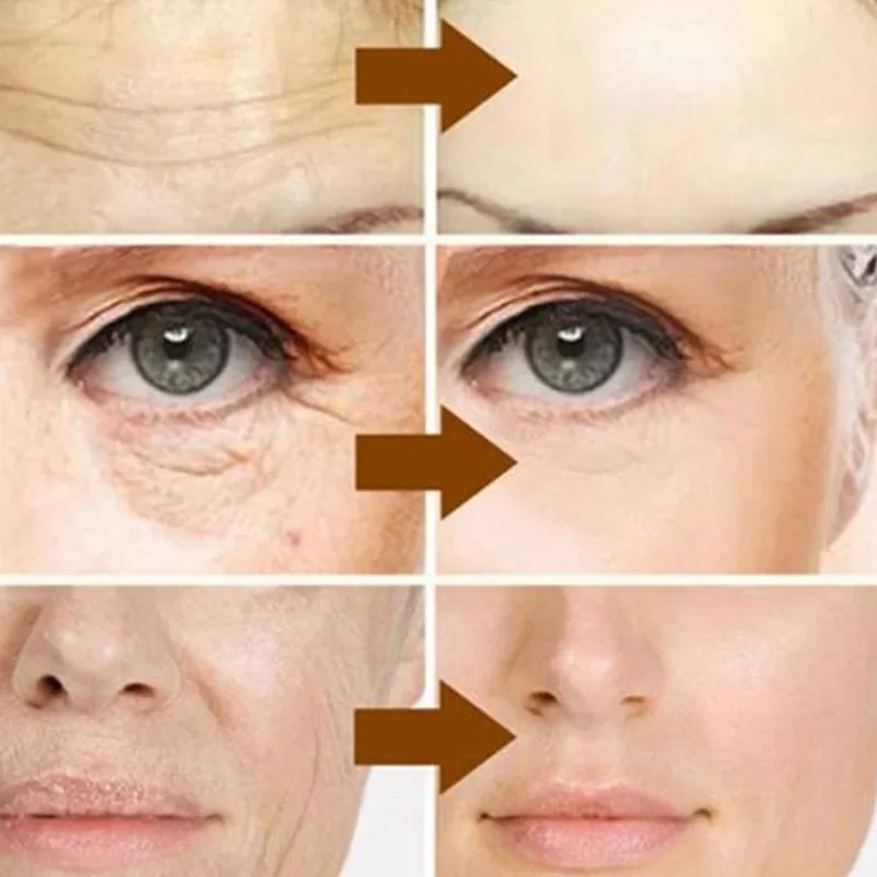 Рисунок 3 - набор увлажняющих антивозрастных