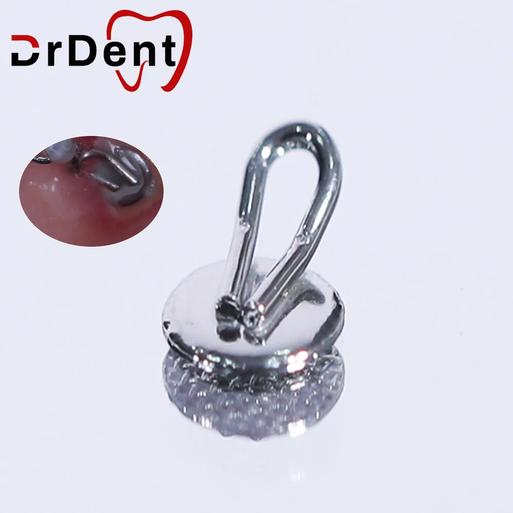 

Drdent Dental 50PCS Orthodontics Lingual Traction Hook Round Rect Metal For Orthodontic Treament Durable Does Not Corrode Sturdy