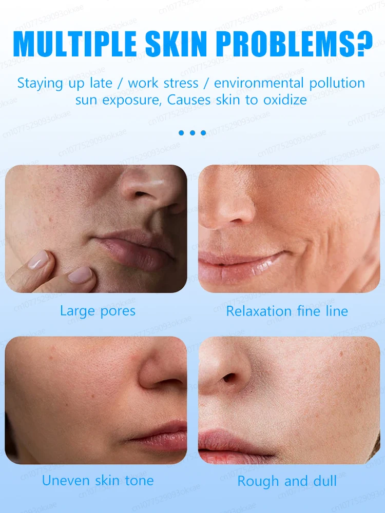 Рисунок 3 - Средство для удаления темных точек на лице