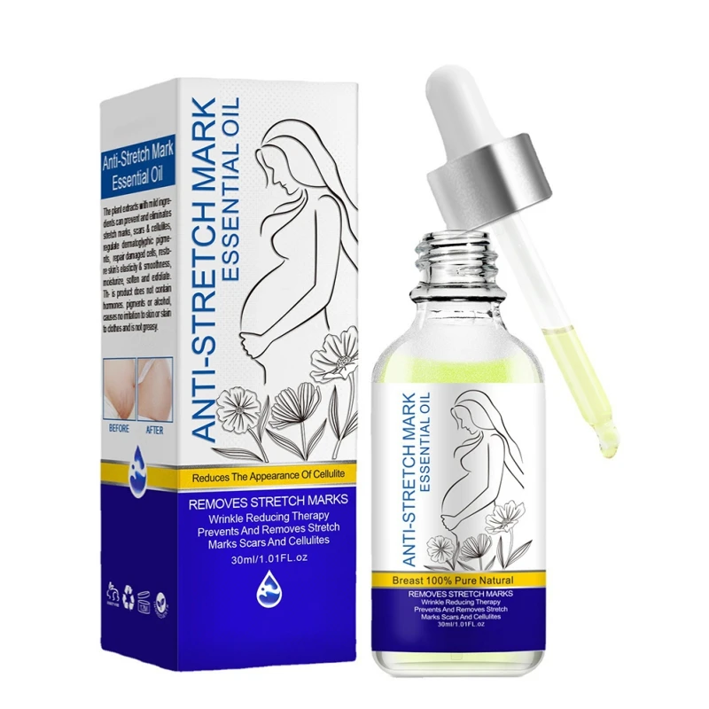 

Stretch Mark Cream 30ml Hypoallergenic Safe for Pregnancy Scar Removal Cream Stretch Marks Removal Skin Care Maternity