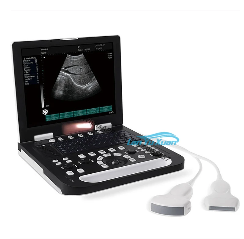 

Advanced Reliable Quality Hospital Full Digital HD Imaging Notebook Black&white Ultrasound Scanner System BW22