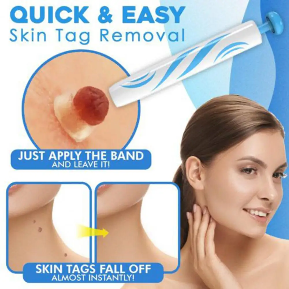 

Practical Skin Tag Remover Portable to Carry Ergonomics Design Mini Swab Cleansing Kit for Adult
