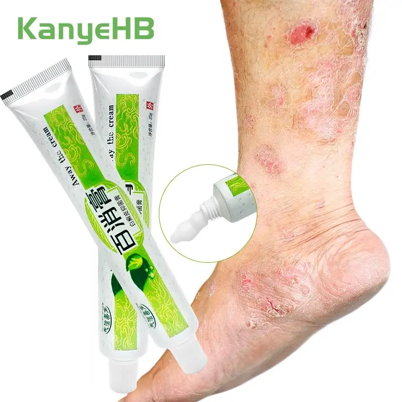 

2Pcs Herbal Psoriasis Cream Moisturizing Repair Skin Antibacterial Exfoliate Relieve Skin Itchy Rough Skin Care Ointment A1301