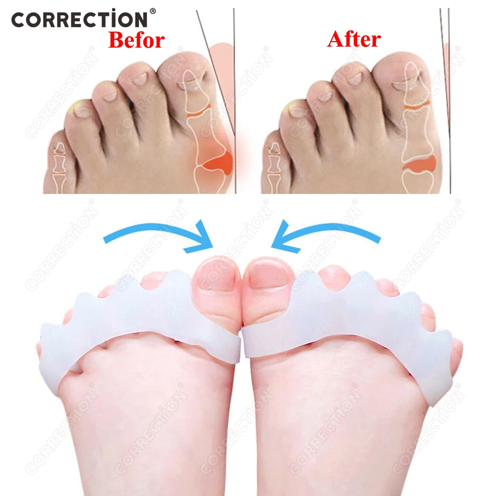 

CORRECTION Soft Silicone Bunion Toe Corrector Nail Protector Foot Skin Care Tool Toe Hallux Valgus Straightener Spreader Unisex