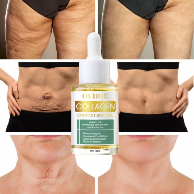 

Коллагеновое подтягивающее антивозрастное эфирное масло для тела, питательное увлажняющее удаление жира в области живота и ног, уход за телом, растительная сыворотка