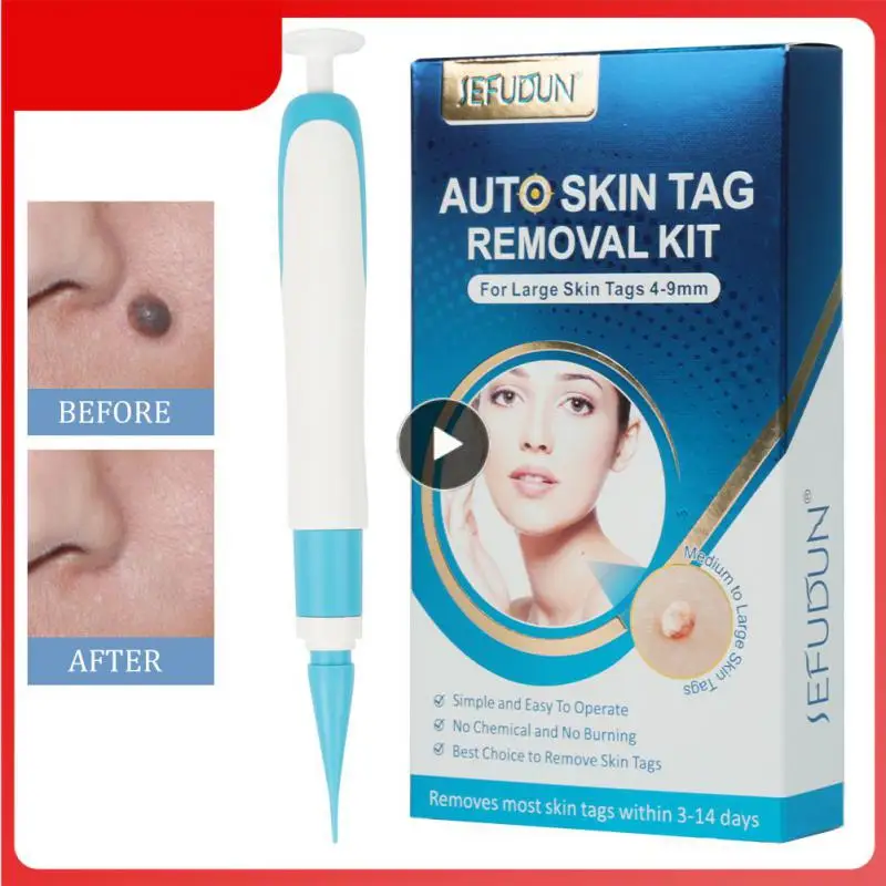 

Skin Tag Remover Skin label Mole Wart Remover pen painless nevus remover skin label removal kit Home Use facial beauty care tool