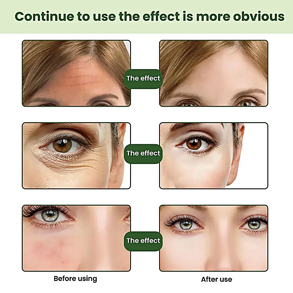 Омолаживающая сыворотка для растений Пептидная Сыворотка подтяжки стволовых