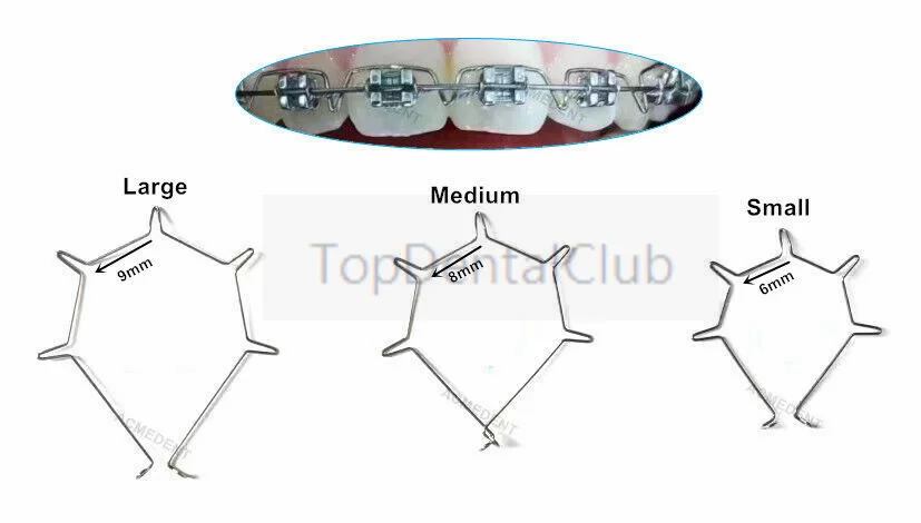 

20pcs Dental Orthodontic Anterior Root Torquing Auxiliary Arch Anterior Root Torque Five-Bend Front Tooth Torque Spring