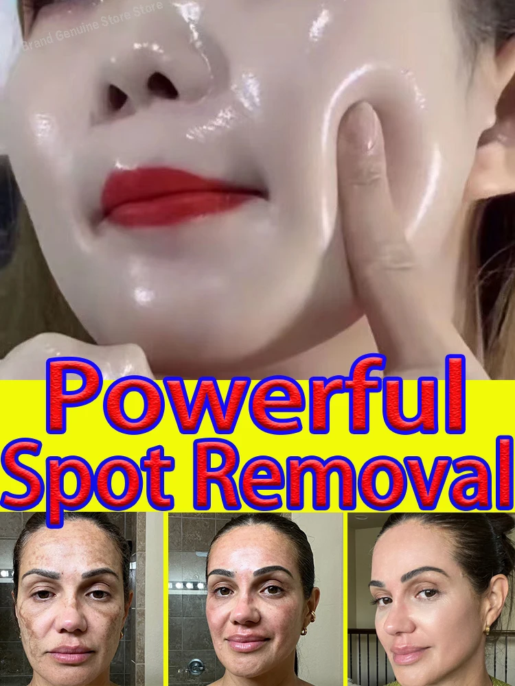 

Freckle Cream Anti Spots Blemish Melasma Spot Dark