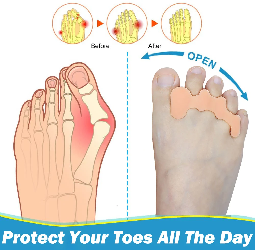 Рисунок 3 - разделители для пальцев ног для