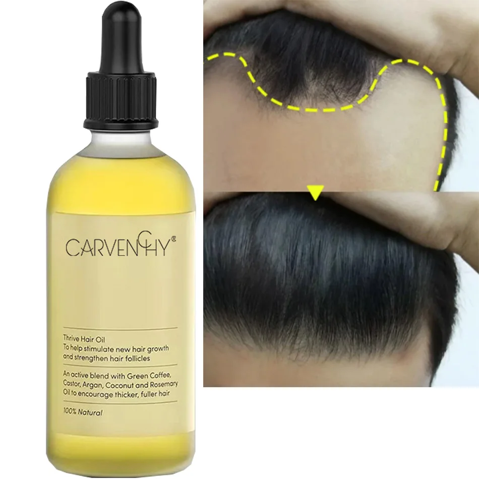 

Масло для роста волос, эффективное восстановление облысения и выпадения волос после родов