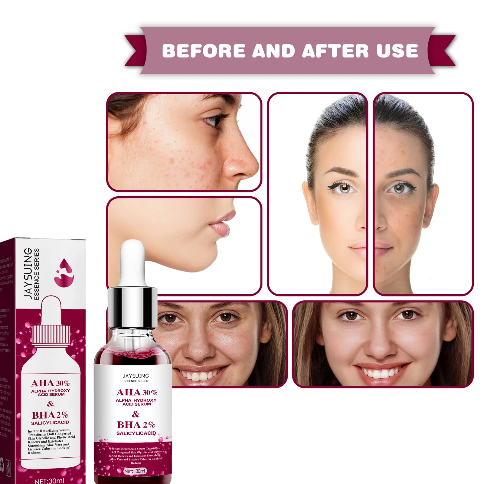 

Экстракт АХА для лица, удаление черных точек, осветление шрамов от акне, сужение пор, деликатная кожа, Осветление ЛИЦА, продукты для ухода за ...