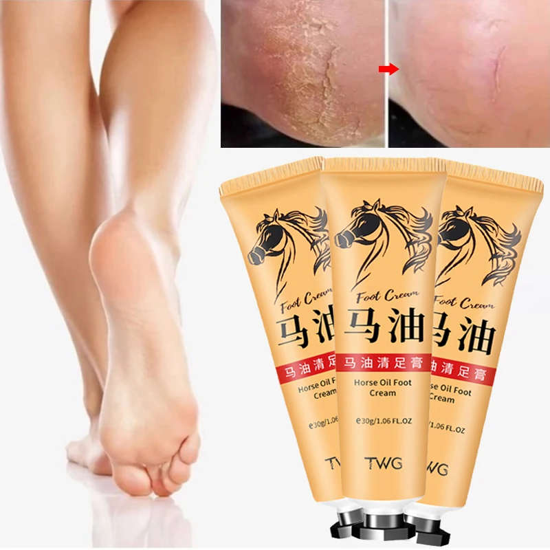 

Mositurizing Foot Care Cream Effective Removal Callus Dead Skin Heel Cracked Repair Cream Anti Crack Dryness Foot Care Products