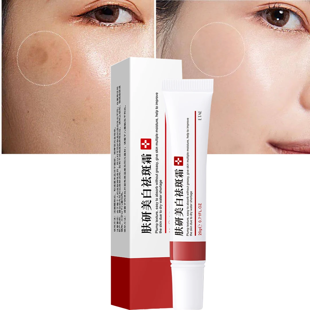 

Whitening Remove Freckle Cream Removal Melasma Sunspots Pigmentation Brighten Moisturize Facial Cream Skin Face Skin Care