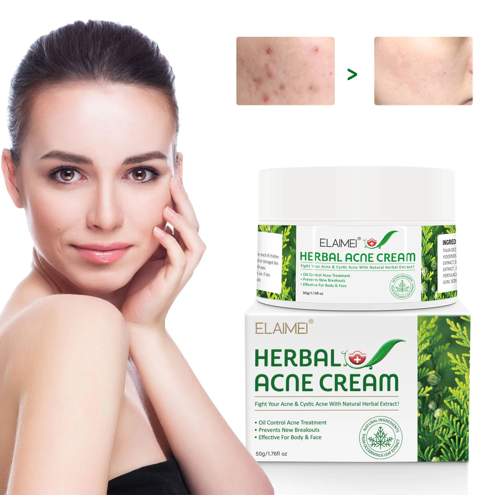 

ELAIMEI Herbal Anti Acne Pimple Healing Cream Acne Spot Treatment Cream for Face and Body