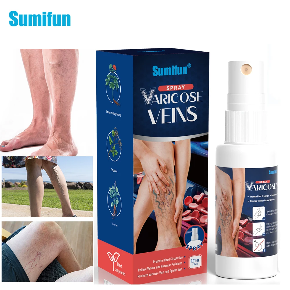 

30Ml Sumifun Varicose Vein Herbal Spray Effective Cure Leg Acid Vasculitis Phlebitis Spider Vein Pain Relief Medical Health Care