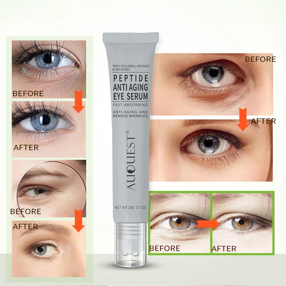 Eye Cream Anti Dark Circle Remove Eye Bags Anti Wrinkle Hyaluronic Acid Cream Roller Massager Skin Care Beauty