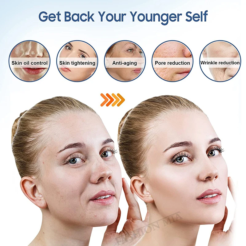 Рисунок 6 - одноразовые картриджи для кожи