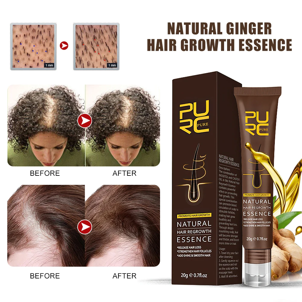 

PURC Fast Hair Growth Oil Prevent Hair Loss Ginger Extract Growing Hair Products Scalp Treatment Hair Care for Men Women 20g