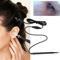 3 in 1 medical use ear cleaning endoscope earpick camera hd earwax removal kit ear care tools support for type c android windows