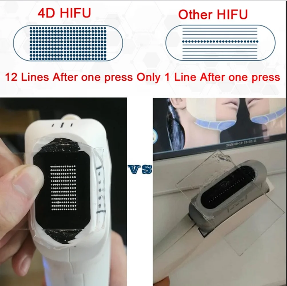 4D 12-линейный HIFU-картридж запасные расходные материалы зонд и ручка для подтяжки