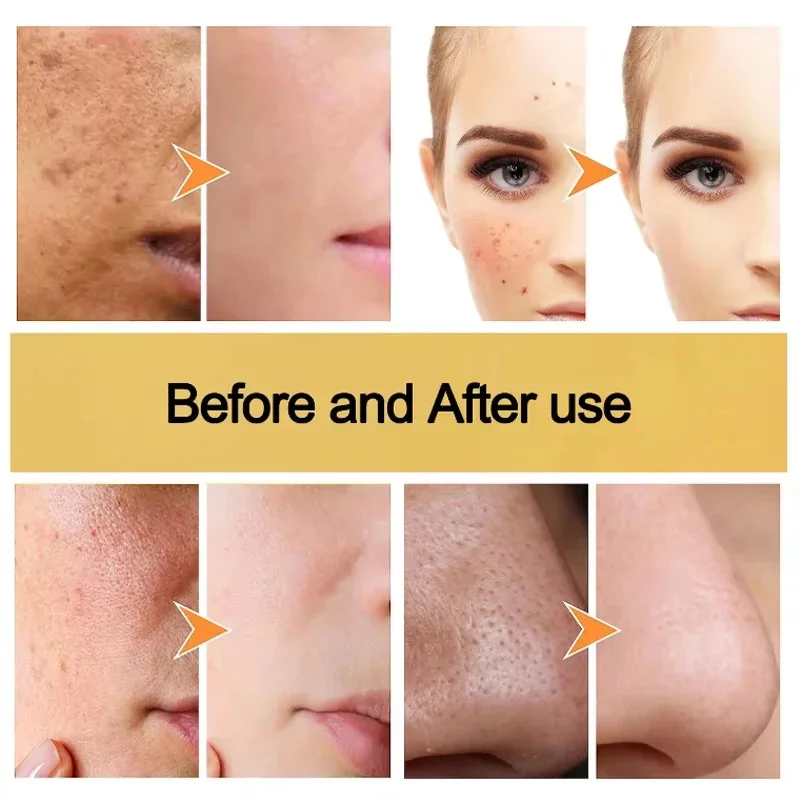 Грязевая маска с куркумой очищающая грязевая витамином С устраняет прыщи