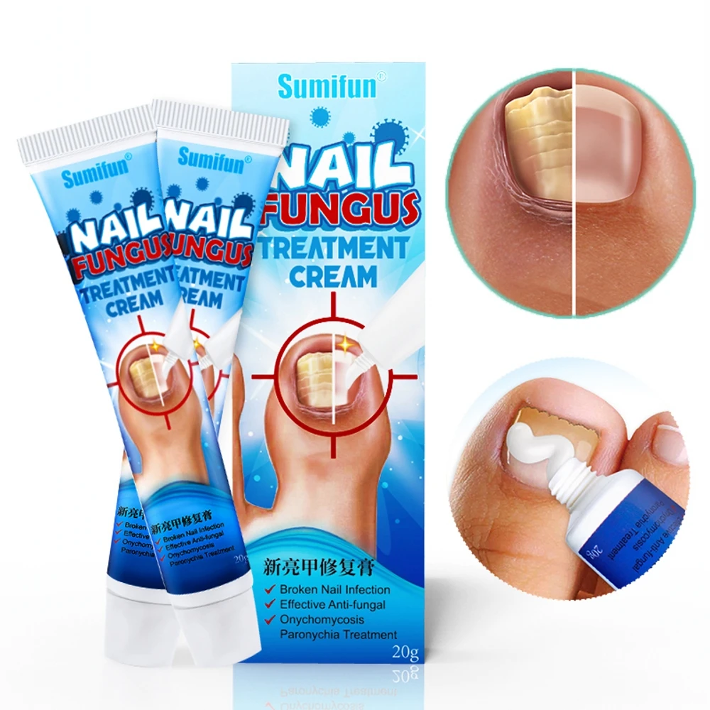 

20g Nail Repair Cream Antibacterial Onychomycosis Paronychia Treatment Ointment Fingers Feet Whitening Care