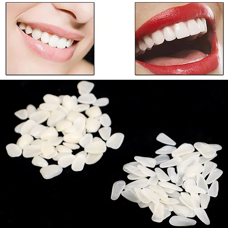 Dental Ultra-thin Whitening Veneer 50 Pieces of Dental Membrane (no Glue) Resin Porcelain Material Temporary Tooth White