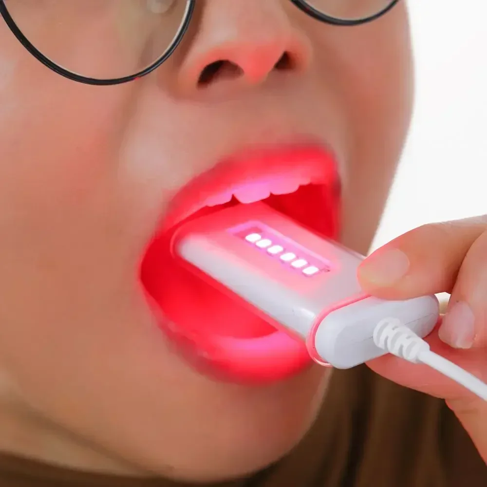 Новая красная фототерапия для холодной боли Canker боль 660 нм ближняя инфракрасная