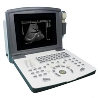 cheap price portable black white ultrasound machine laptop ultrasound scanner equipment in china