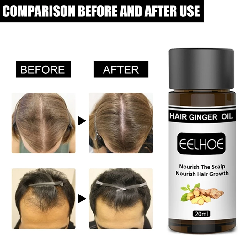 Эссенция для роста волос против выпадения густые волосы быстрое восстановление